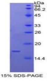 SDS-PAGE (CASP9-626H).jpg
